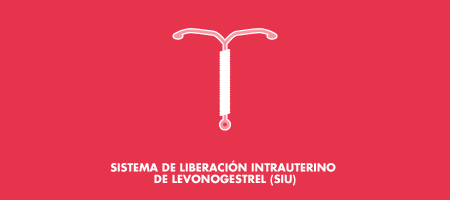 Sistema de Liberación Intrauterino de Levonogestrel (SIU)